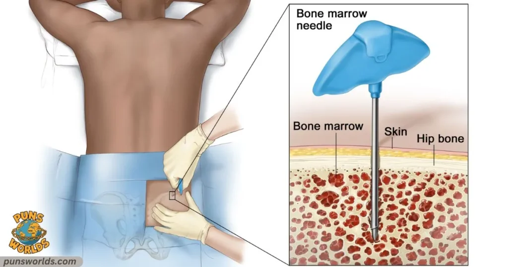 Bone marrow biopsies 